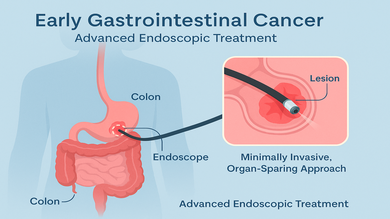 early-cancer-endoscopic-treatment