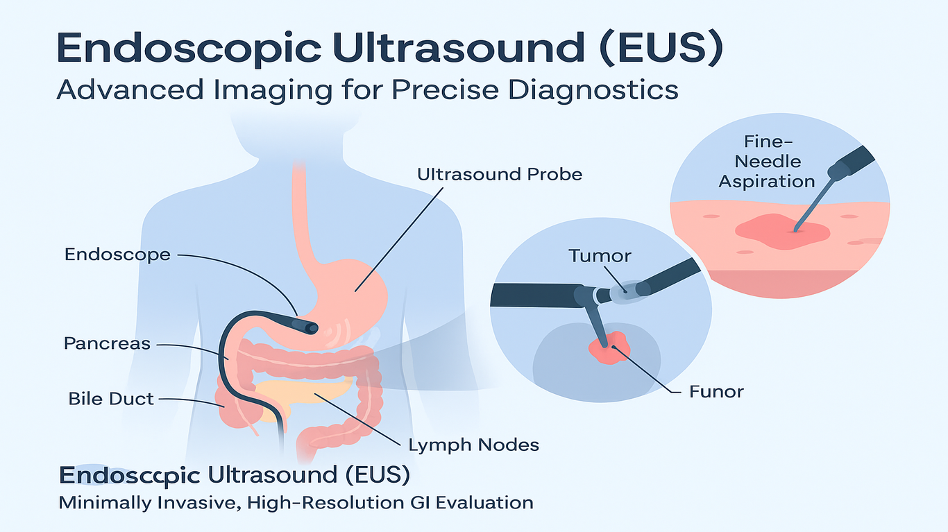 endoscopic-ultrasound