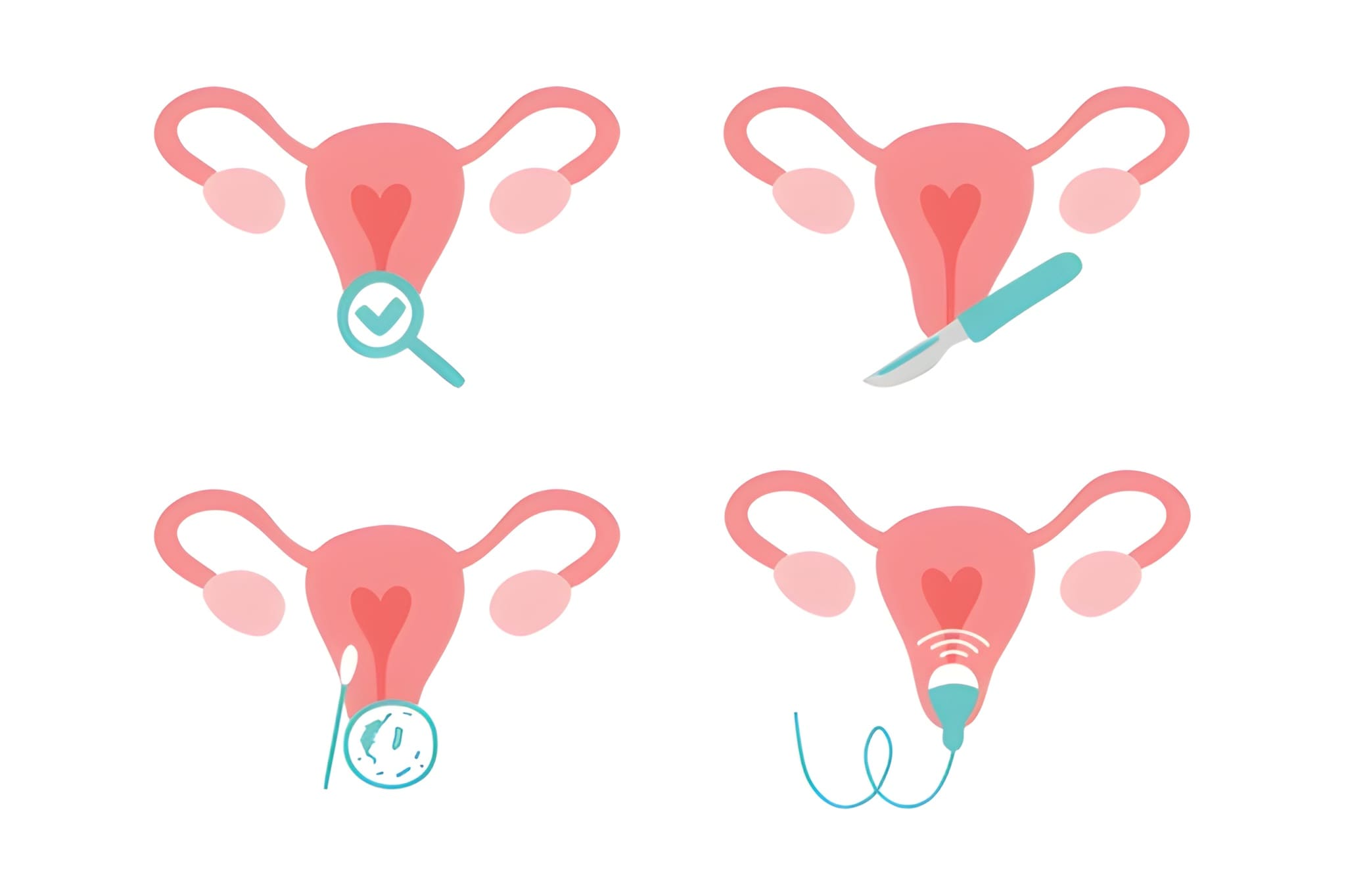 Minimally Invasive Surgery