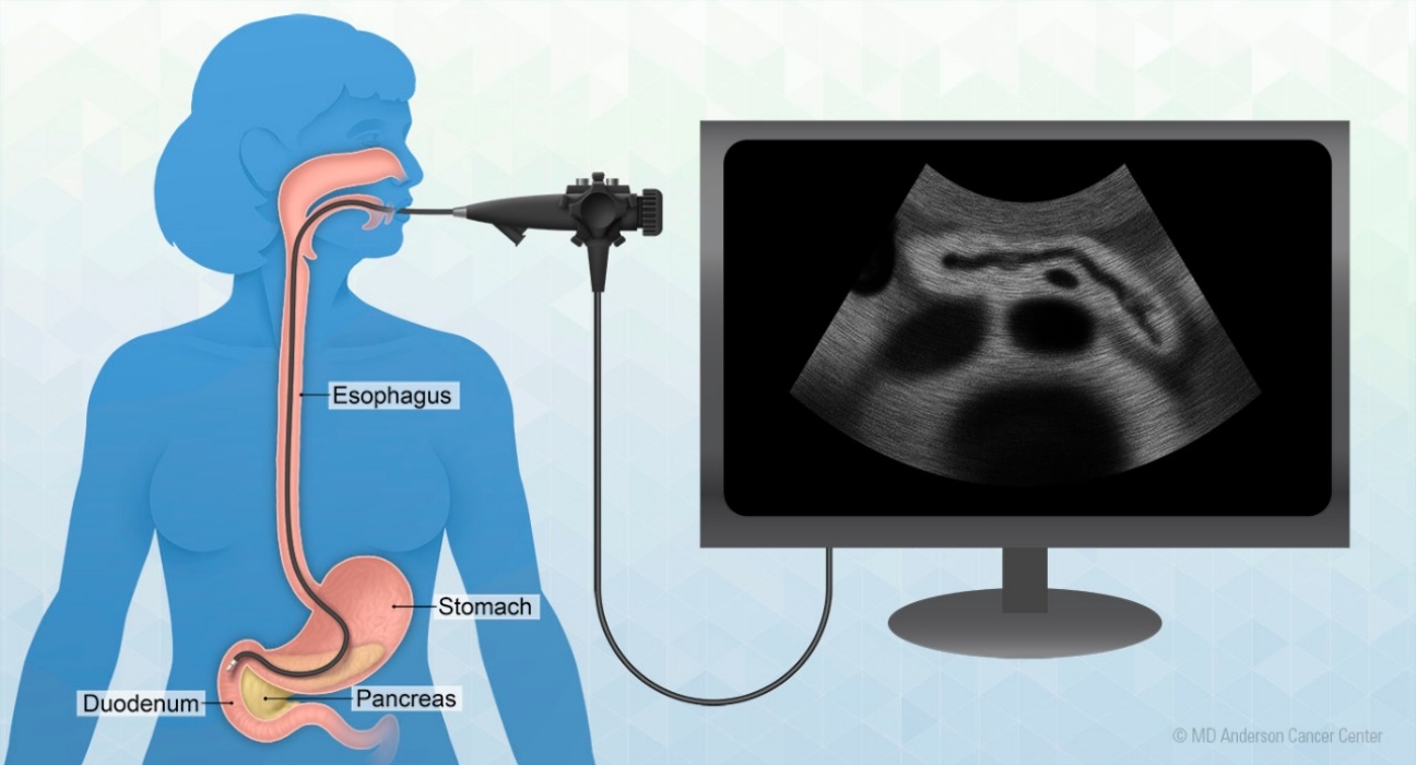 Safe ARMS procedure facility