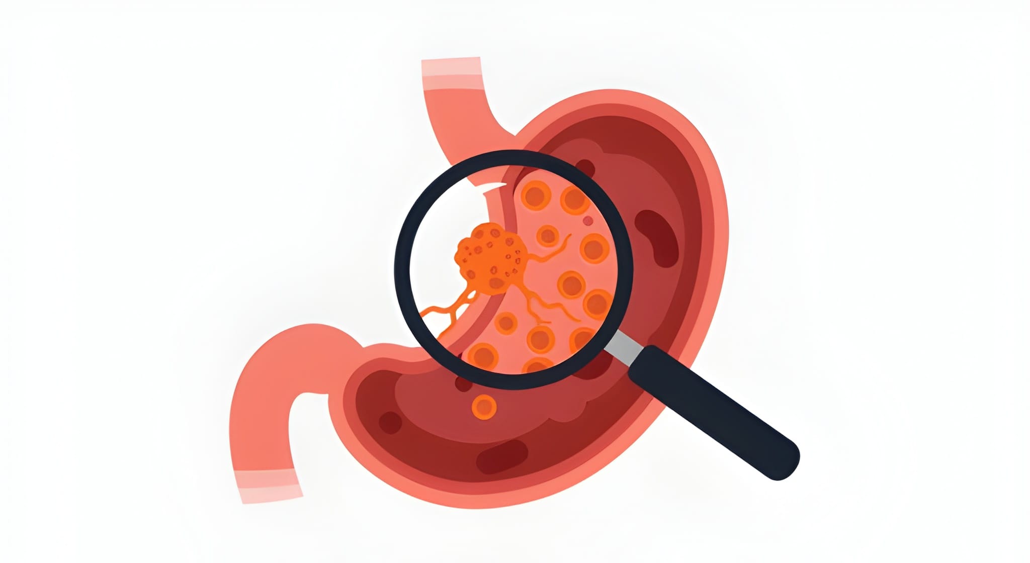 Advanced endoscopic treatment equipment
