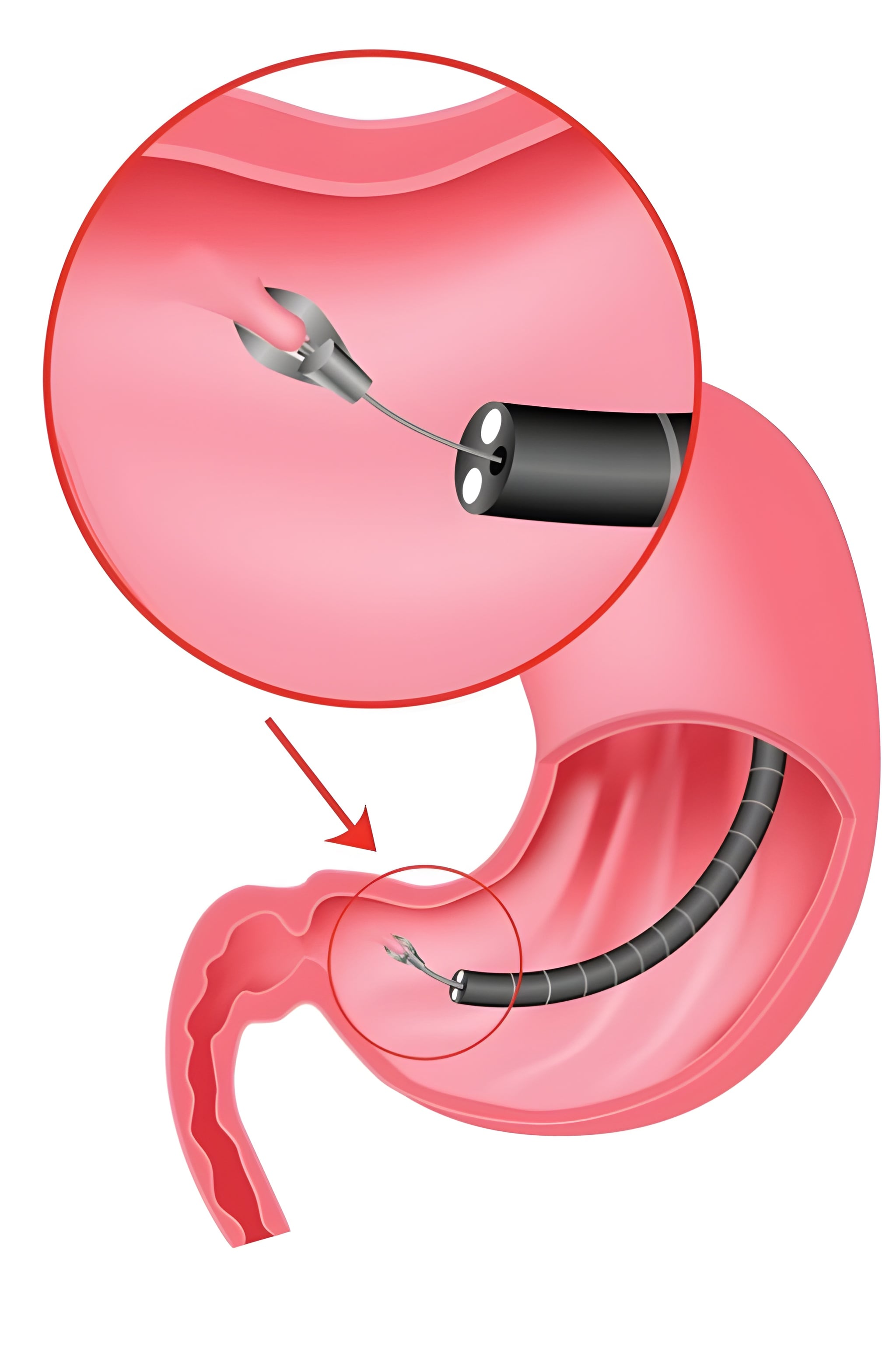 Medical professional viewing high-definition endoscopic imagery on monitor