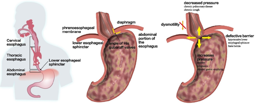 Long-term patient recovery