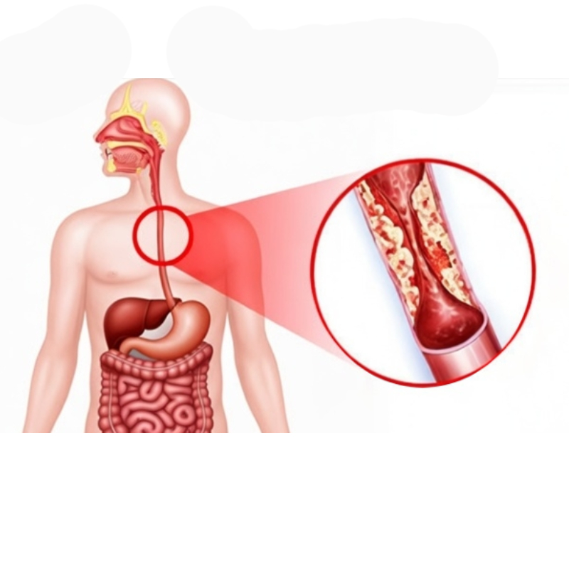 Modern POEM procedure facility