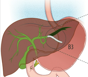 Reduced medication dependence