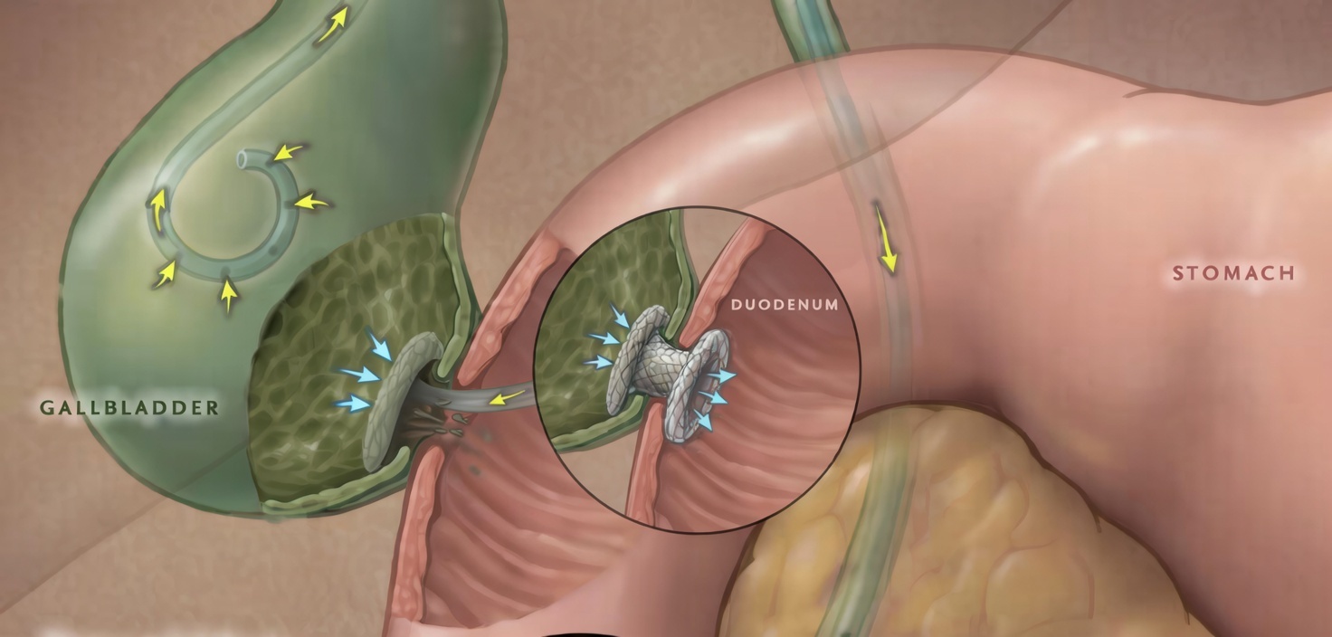 Medical professional viewing high-definition endoscopic imagery on monitor