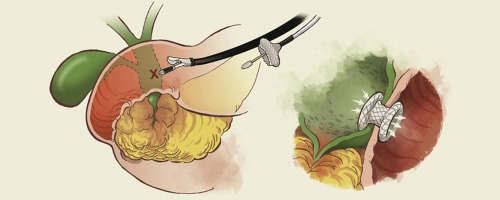 Long-term patient recovery