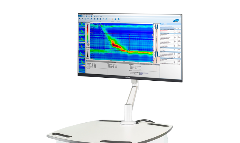 Upper GI Endoscopy Equipment