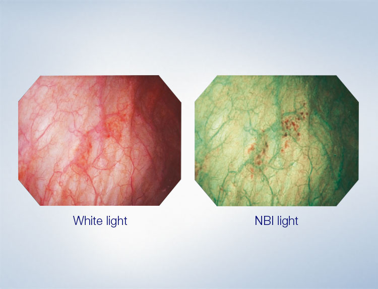 Medical professional viewing high-definition endoscopic imagery on monitor