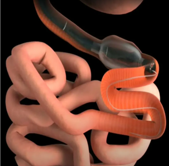 Medical professional viewing high-definition endoscopic imagery on monitor