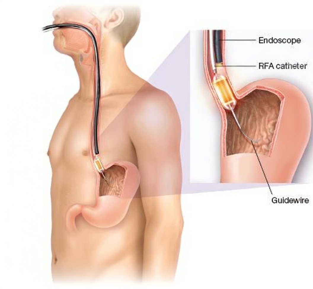 Modern colonoscopy medical room with advanced equipment