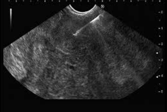 Medical professional viewing high-definition endoscopic imagery on monitor