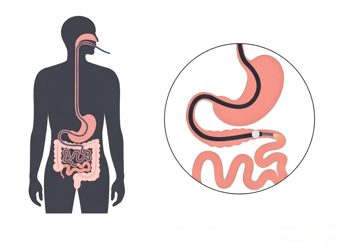 Upper GI Endoscopy Equipment