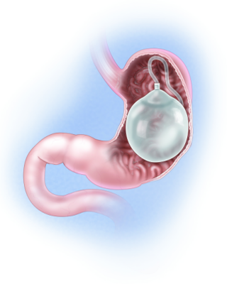 Long-term patient recovery