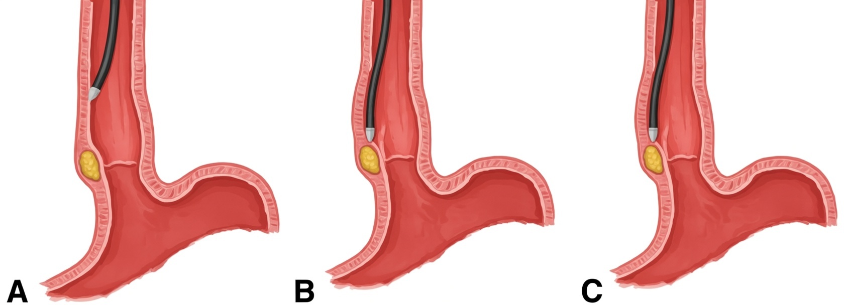 Advanced endoscopic equipment