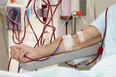 Dialysis Services