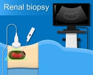 Renal Biopsy