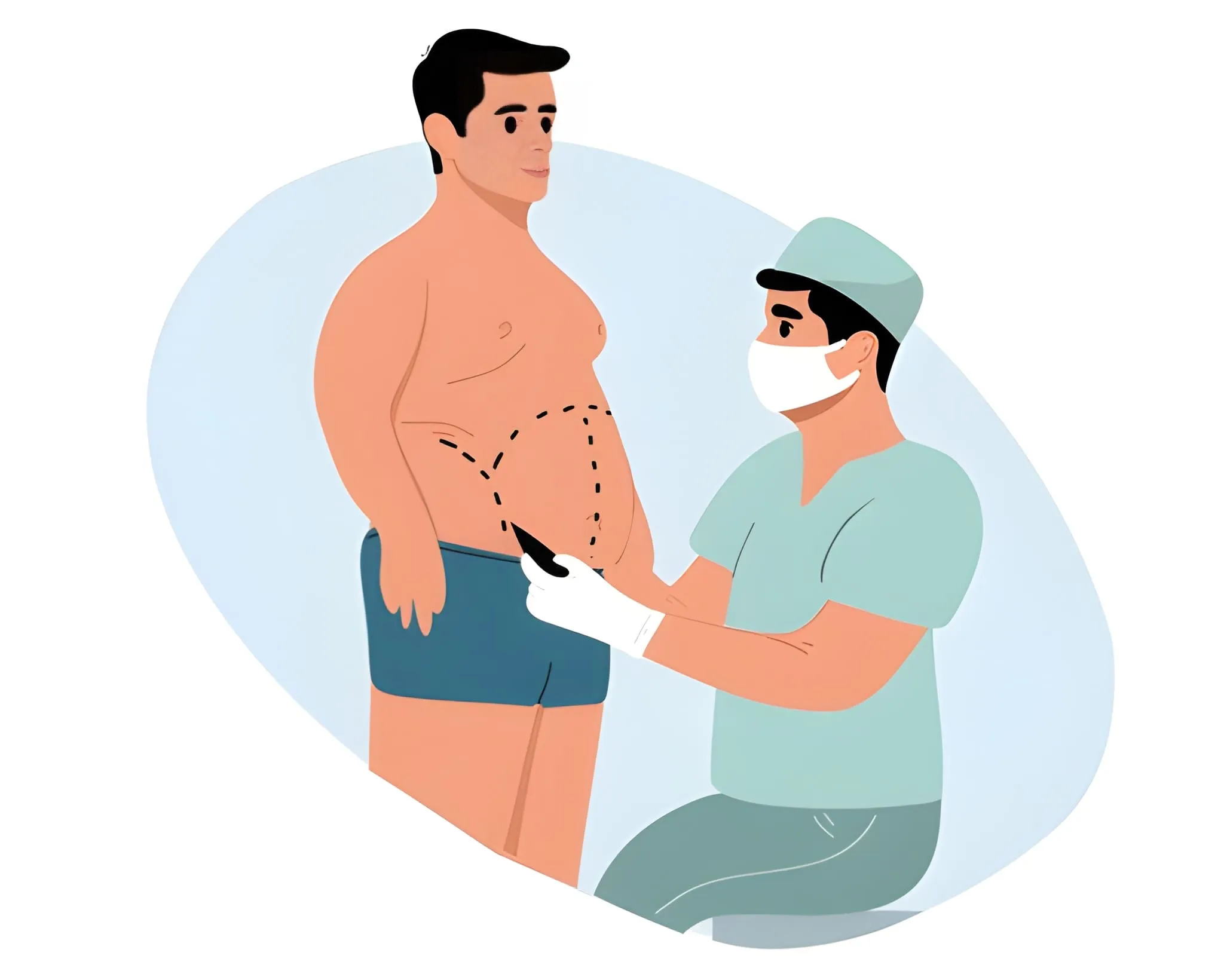 Abdominoplasty