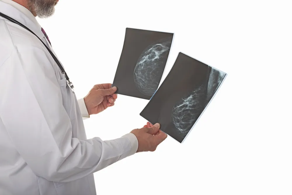 Mammography